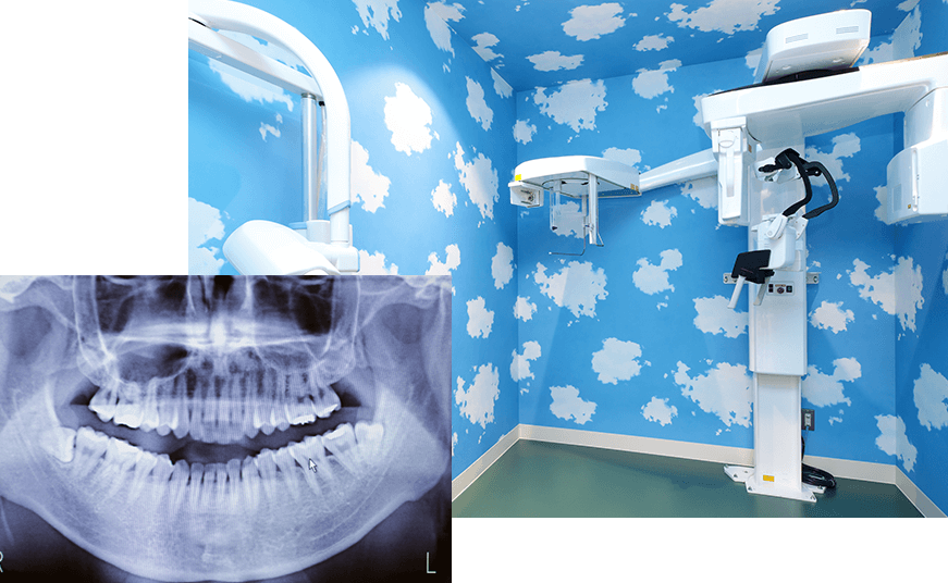 歯科用CTで安心できる正確な診断