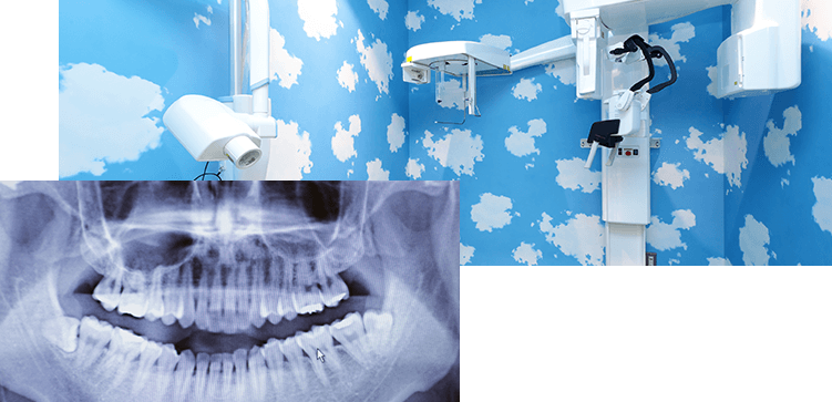 歯科用CTで安心できる正確な診断